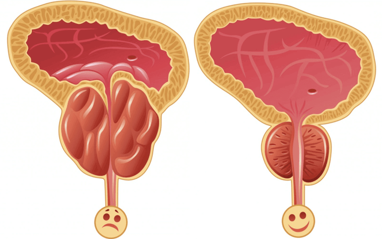 uzroci problema s potencijom kod muškaraca
